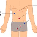 탈장 원인과 증상 종류 (서혜부배꼽항문 탈장) 소아탈장 정리 이미지