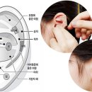 이혈요법 이미지