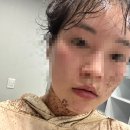 공업탑피부관리