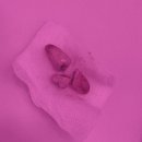 사랑이아프니치과의원 | 왼쪽 사랑니 위아래 한번에 뽑은 후기 (사랑이 아프니 홍대점)