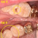 매직치과기공소 이미지
