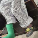 에스메디약국 | 골절 수술 후 12일째