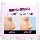 마블성형외과의원 이미지