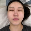 리뉴메디칼 대구지사 | 대구 리프팅 전문 에스테틱 아미뷰티 온다리프팅 효과가 있는 티리온X 찐후기