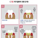 홍익치과 네이버블로그