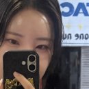 제이마시 | [공지] 이마필러 6cc 시술 후기 – 자연스러운 볼륨으로 인상 개선