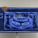 최원혁사랑니치과의원 이미지