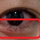 영종연세안과의원 이미지