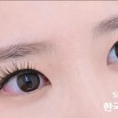 제로메디 네이버블로그