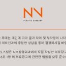 엔브이성형외과의원