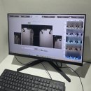 미래에너지시스템 | 압구정피부과 하이퍼 티타늄리프팅 솔직 후기, 옆볼패임 시술 효과 내돈내산