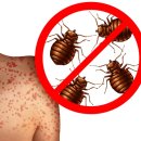 가벼운 뇌경색도 위험?… 환자 30% 치매 유발 물질 쌓였다뇌의 인지기능 영역 손상 없어도 &#39;베타...
