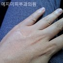 예지미피부과의원 네이버블로그