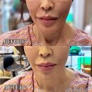 리앤클의원 네이버블로그