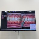 더케이동물병원 | 더케이365치과병원 ｜인천 치아미백 내돈내산 후기