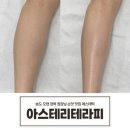 손맛테라피 | 인천탈모관리 아스테리테라피에서 하체순환 받고온 솔직 후기(손맛 맛집)