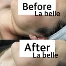 라 벨르 에스테틱 이미지