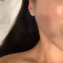 소원한의원 | [부산] 서면 편평 사마귀제거 잘하는 한의원 추천