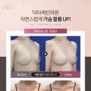 바디업의원 네이버블로그