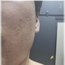 딩동 쿡 | 양산피부관리 - 프라이빗한 힐링 공간, 아름자리 에스테틱 &amp; 왁싱에서 수분 충전 완료!