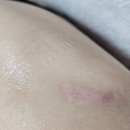 봄메디칼 이미지