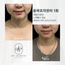 정성약국 | 강남피부관리 서울 강남구 논현동 에떼에스테틱 위치 가격 후기 추천