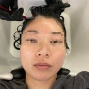 솔라티움시티 강남 | 강남역 미용실 슬론헤어 두피클리닉 후기｜유진디자이너 두피관리 만족