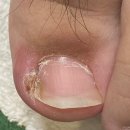 예담네일