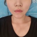 로하나코스킨