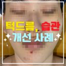 정원장피부관리실 | 광주 이마 좁쌀·턱 염증 여드름 개선 사례｜백운동 피부관리