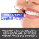 청주임플란트 아름다운 미소라인 만들기! 이미지