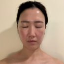 미인창조 - 순천시 | 강동 명일동피부관리 미인본가, 작은얼굴 비대칭관리 찐후기