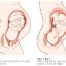 진통[labor] 이미지