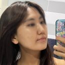 나프라우드 판토아프 로 여드름 관리한 후기