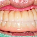 아치치과기공소 이미지