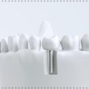 명지화이트치과의원 이미지