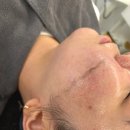 세인트메디칼서비스 | 명지 스킨플래닝 전문 '세인트뷰티' 피부의 신세계를 경험한 리얼 후기