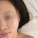 스킨카페 | 을지로입구역 피부과 | 물광주사 스킨보톡스 솔직후기 효과 통증 총정리