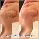 경화에스테틱
