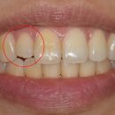 선치과기공소 이미지