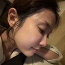 진한약국 | 출산 후 폭발한 기미, 약국기미연고 멜라노사 크림으로 관리해본 후기