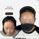 헤어라인 이미지