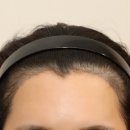 선헤어라인 이미지