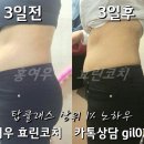 홍여우 - 광주시 | 홍여우