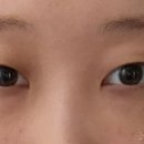 인트로성형외과의원 이미지