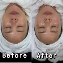 더 베스트 | 양재역 피부관리 미더베스트 셀럽 시크릿 케어 후기