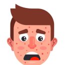 카프리 | 근본적인 여드름 치료 피지선 파괴 카프리 레이저 후기