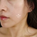 이프아 에스테틱