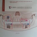 드림치과(해운대)-강재문인프란트 사진1250만원. 이미지