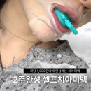 라이브유통 | 라이브오랄스 퓨어다이아 치아미백제 :: 부작용 없는 '테라로바' 셀프치아미백 키트 후기